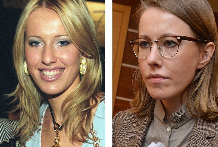 Ксения собчак после операции фото ШОК! Знаменитости после ринопластики Gossip Дзен