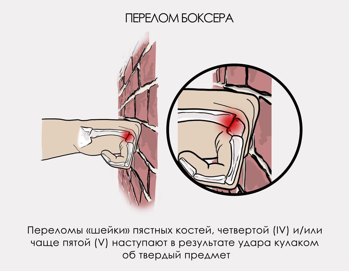 Ортопед Володин перечислил самые частые дачные травмы: первая помощь при ЧП