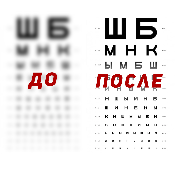 Нужно ли человеку зрение. Зрение минус. Зрение -1.75. Зрение -2.5. Зрение -1.5