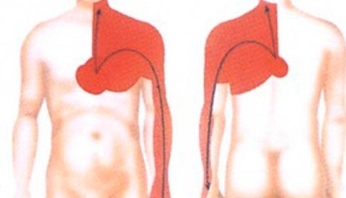 Локализация болей при стенокардии