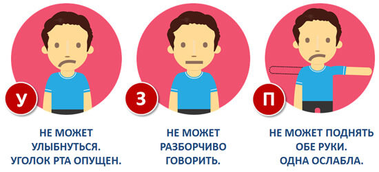 Правило УЗП при инсульте - улыбнуться, заговорить, поднять (руку). В английском варианте - FAST (где последняя буква это time - время, говорит о том, что нужно действовать быстро).