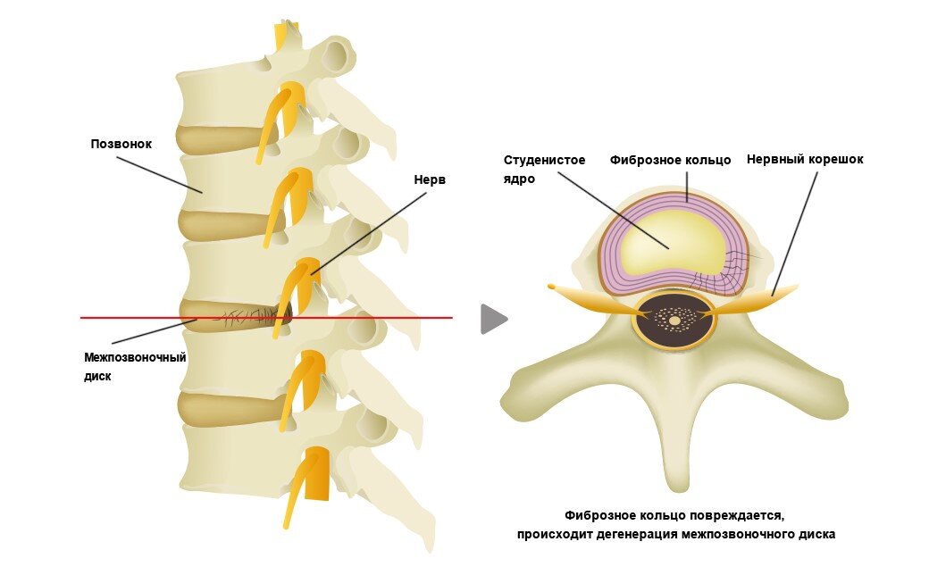 Название дисков позвоночника фото с названиями