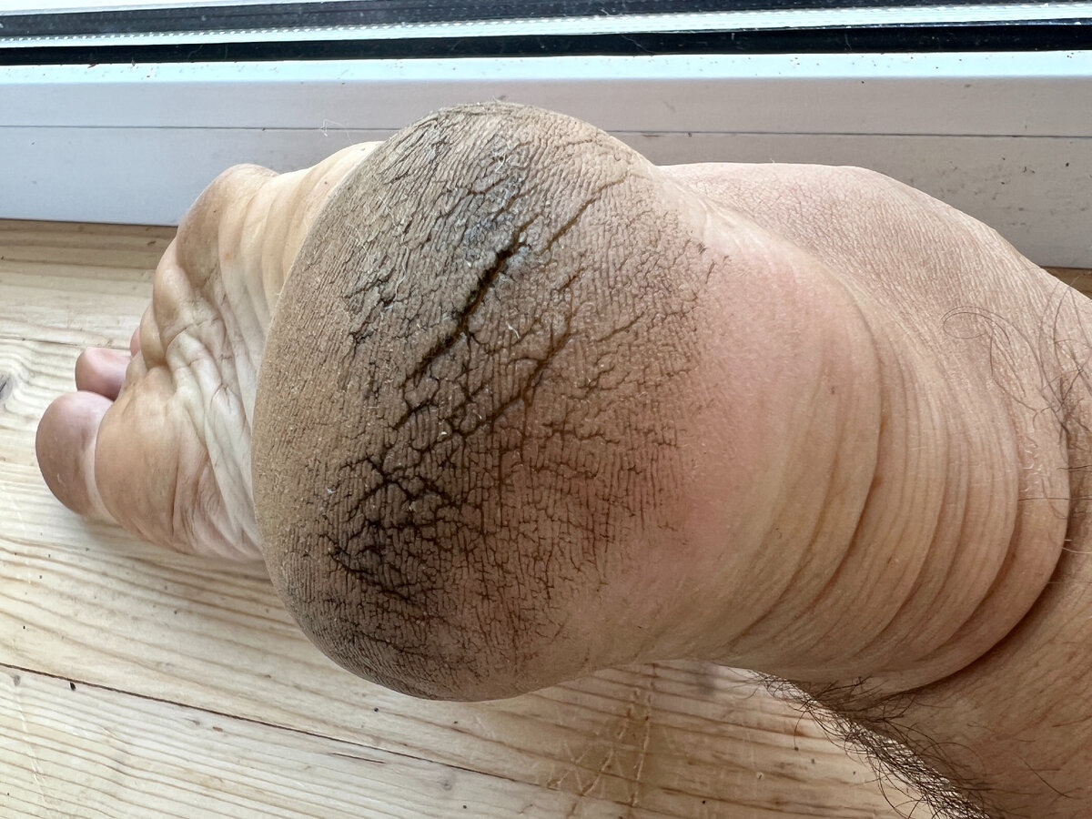 Как избавиться от трещин на пятках