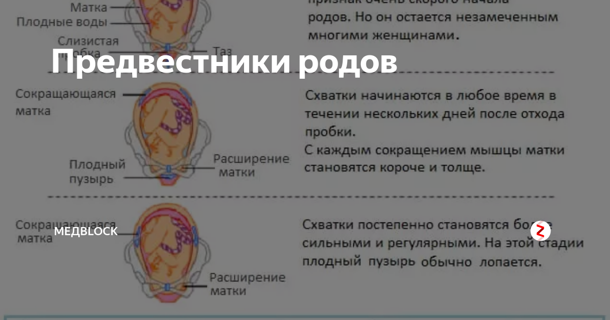 Через сколько после родов начинаются роды. Пробка при беременности. Пробка прибиремености. Отошла пробка при родах. Отхождение вод перед родами у первородящих