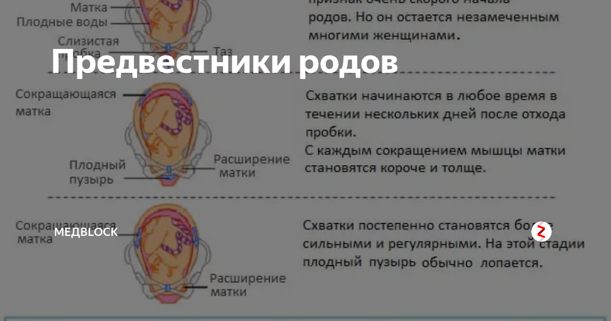 Плохо сокращается матка после родов. Отошла пробка при родах. Пробка отходит при беременности. Предвестники родов.