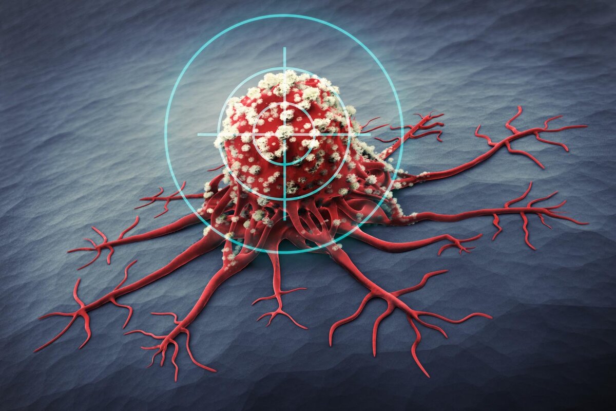 How Expensive Is Targeted Therapy? Cancer Rx Cost Breakdown