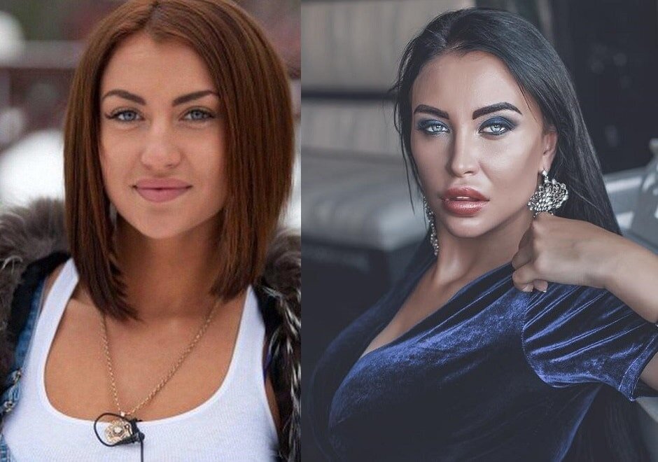 Виктория до пластики фото