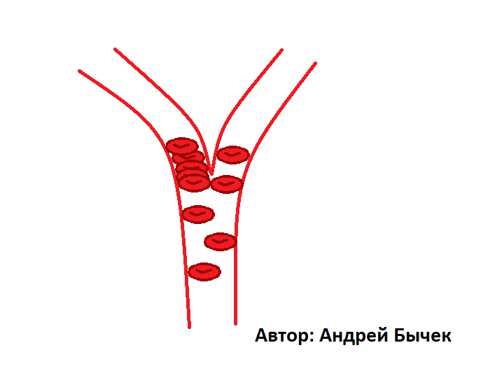Схема расположения слипшихся  эритроцитов в капилярах