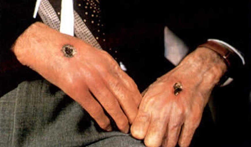 Фото стигматов в районе запястья 