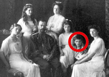 17 АПРЕЛЯ 
Всемирный день гемофилии

Как ни прискорбно это для «сильного пола», но он чрезвычайно уязвим. И ладно бы мелкие неудачи, но есть глобальная напасть, и дело тут в «кровных интересах». Гемофилия, «болезнь королей» - наиболее известное нарушение свертываемости крови. Самый мелкий порез, травма означали сильное кровотечение, а иногда и смерть. Под прицелом – мужчины. По данным безжалостной статистики один мальчик из 10 тысяч поражен гемофилией. Из-за особенностей хромосом, женщины могут по наследству передавать смертельный недуг своим потомкам, но не страдают от него сами. Наиболее известной носительницей гемофилии являлась английская королева Виктория, «бабушка Европы», а ее потомок, так и не ставший российским императором, Алексей Николаевич Романов, страдал от этой болезни всю свою недолгую жизнь.

"Хроники. Истории про врачей, пациентов, фармацию и медицинскую науку".
Клуб любителей истории медицины.
http://hroniki.org

