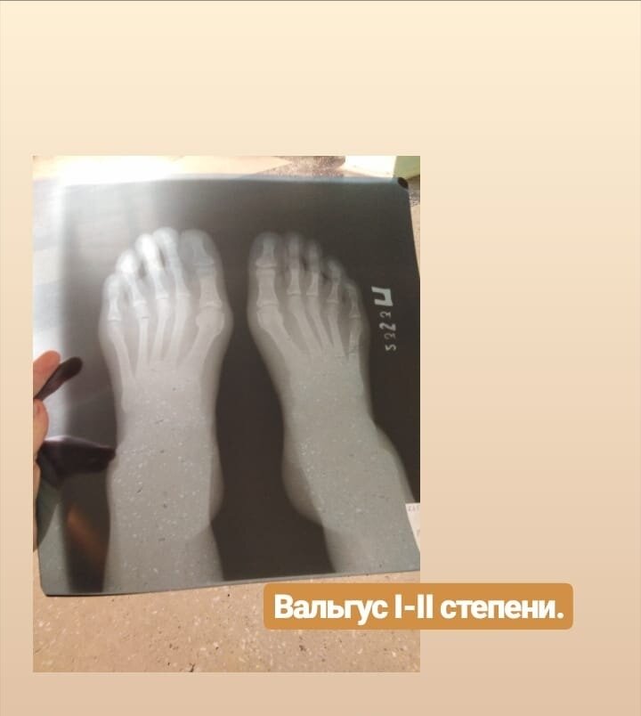 Снимок стоп от 10.02.2020