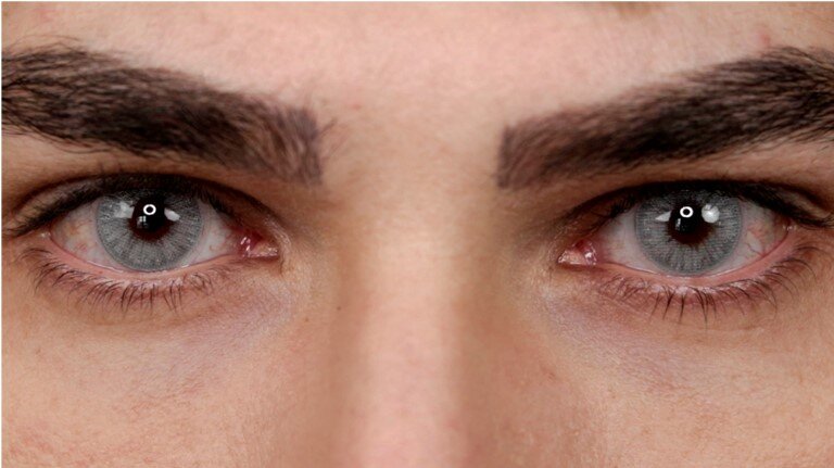 https://upload.wikimedia.org/wikipedia/commons/2/2d/Gold_to_green_heterochromia_in_a_man.jpg