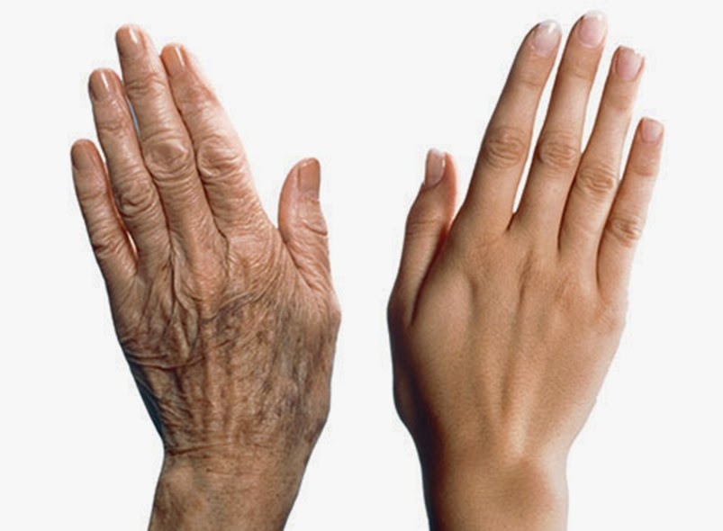 Так стареют руки