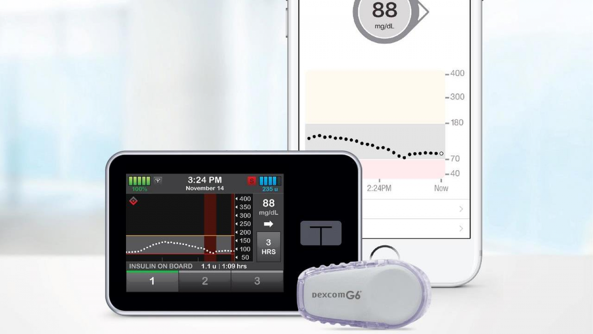 Tandem зарегистрировала первую в своем классе «Инфузионную помпу с возможностью использования альтернативного контроллера» 