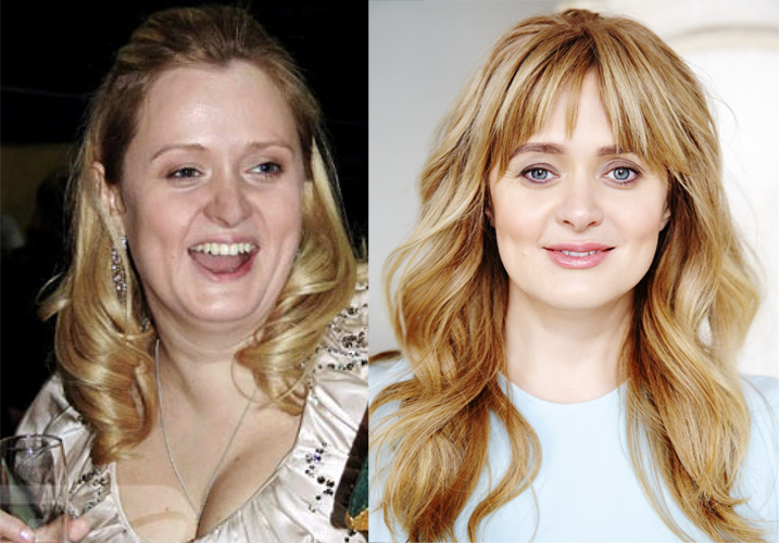 Дочь валерии до и после похудения фото до и после