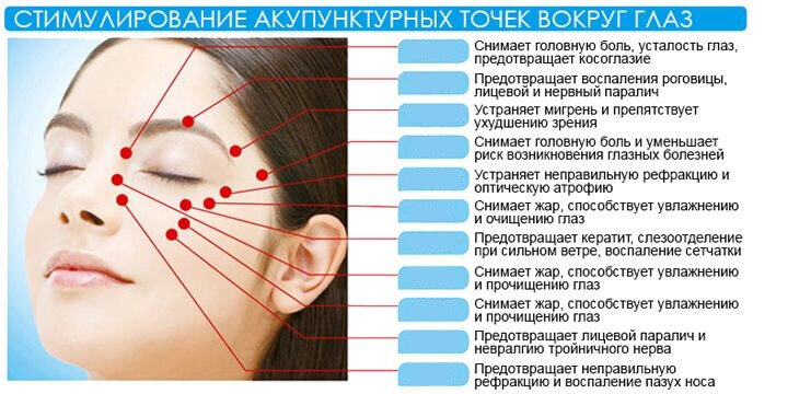 Точки от головной боли: акупунктура, техника, показания -  insultinfo.ru