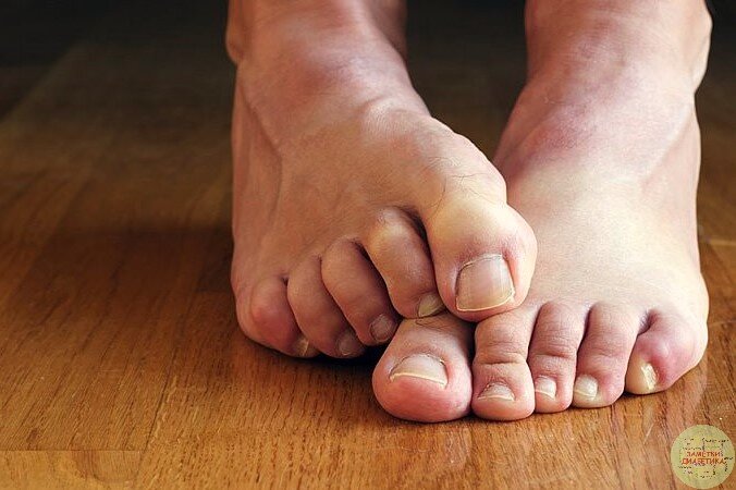 Фото с сервиса Яндекс. Картинки