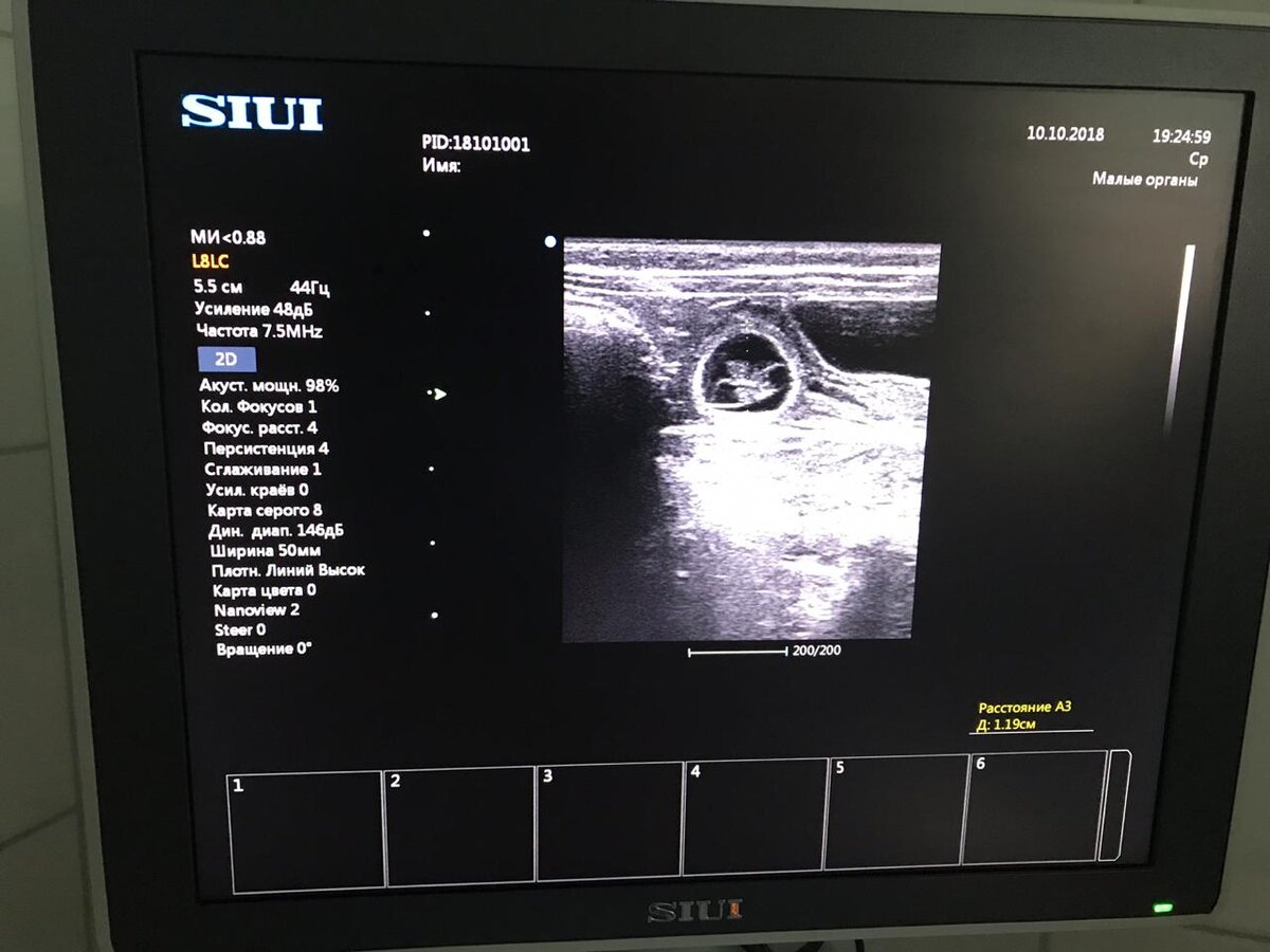 Срок 17-19 дней