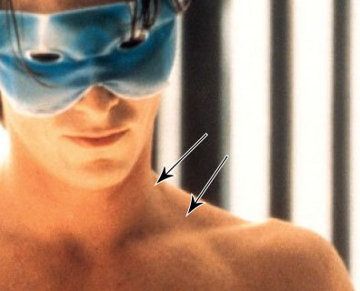 Кристиан Бейл в фильме «Американский психопат» (2000). Стрелочками отмечена надключичная область, в которой расположены описываемые лимфоузлы. 
Источник: kinopoisk.ru