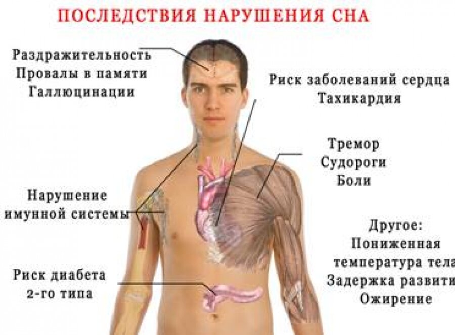 научные источники: 
1. Nedeltcheva AV, et al. Insufficient sleep undermines dietary efforts to reduce adiposity. Ann Intern Med. (2010)
2. Luboshitzky R, Shen-Orr Z, Herer P. Middle-aged men secrete less testosterone at night than young healthy men. J Clin Endocrinol Metab. (2003)