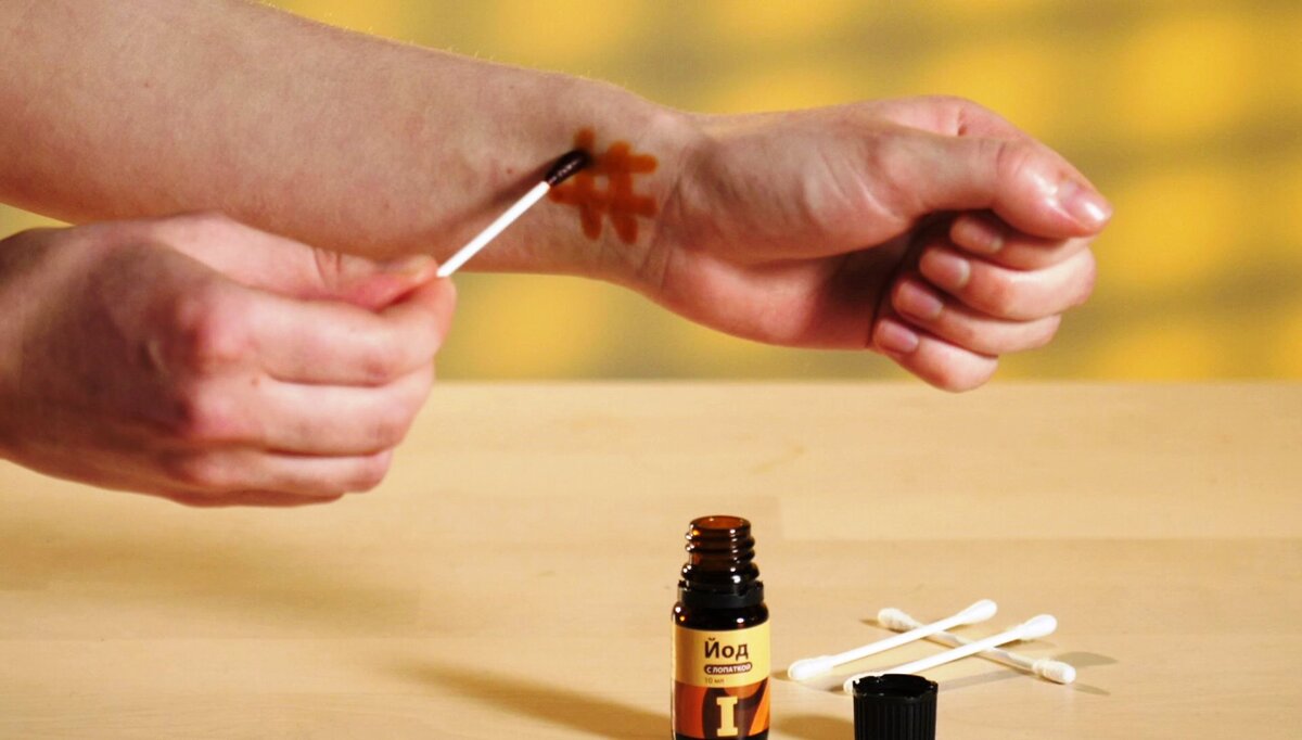 Обрабатываем рану обеззараживающим раствором