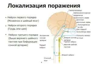 Синдром Горнера у собак - Ветеринар Карлсруэ - Центр мелких животных Арндт