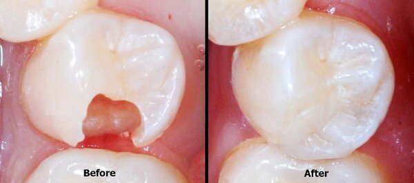 Источник: dentalperfection.in