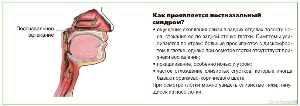 Чем лечить постназальный затек у взрослого