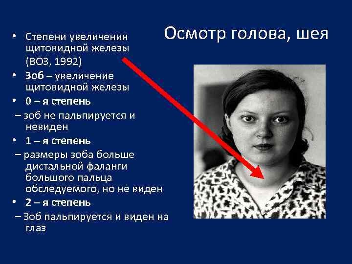 Гипотиреоз: симптомы, диагностика и лечение | МЦ Эндомедис