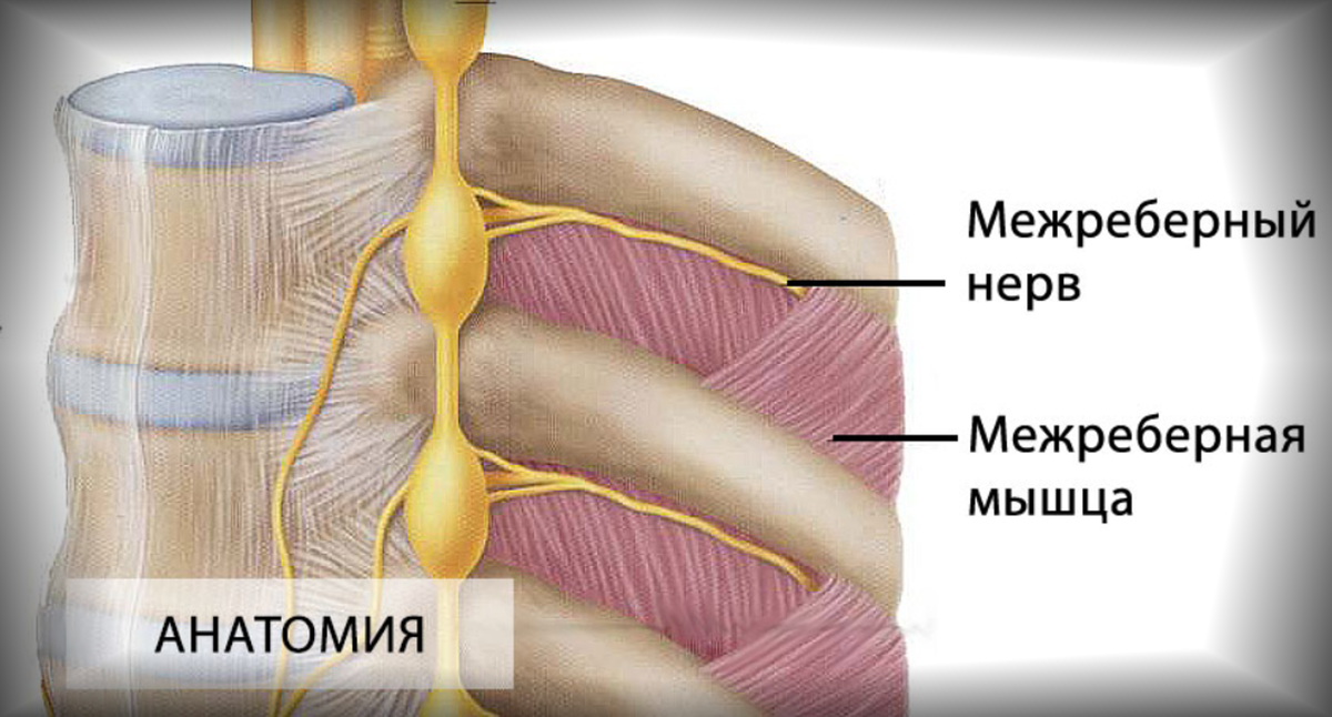 Защемление межреберного нерва