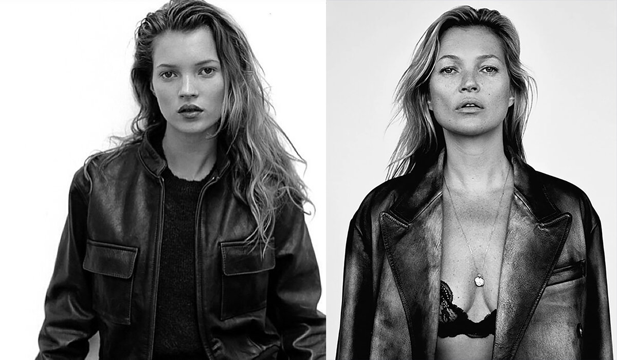 Kate Moss Diabetes