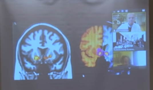 мозги наркомана и пользователя смартфона