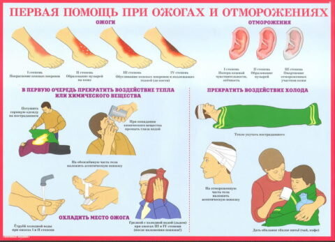  Каждый человек должен знать, как оказать помощь при ожогах и отморожениях.