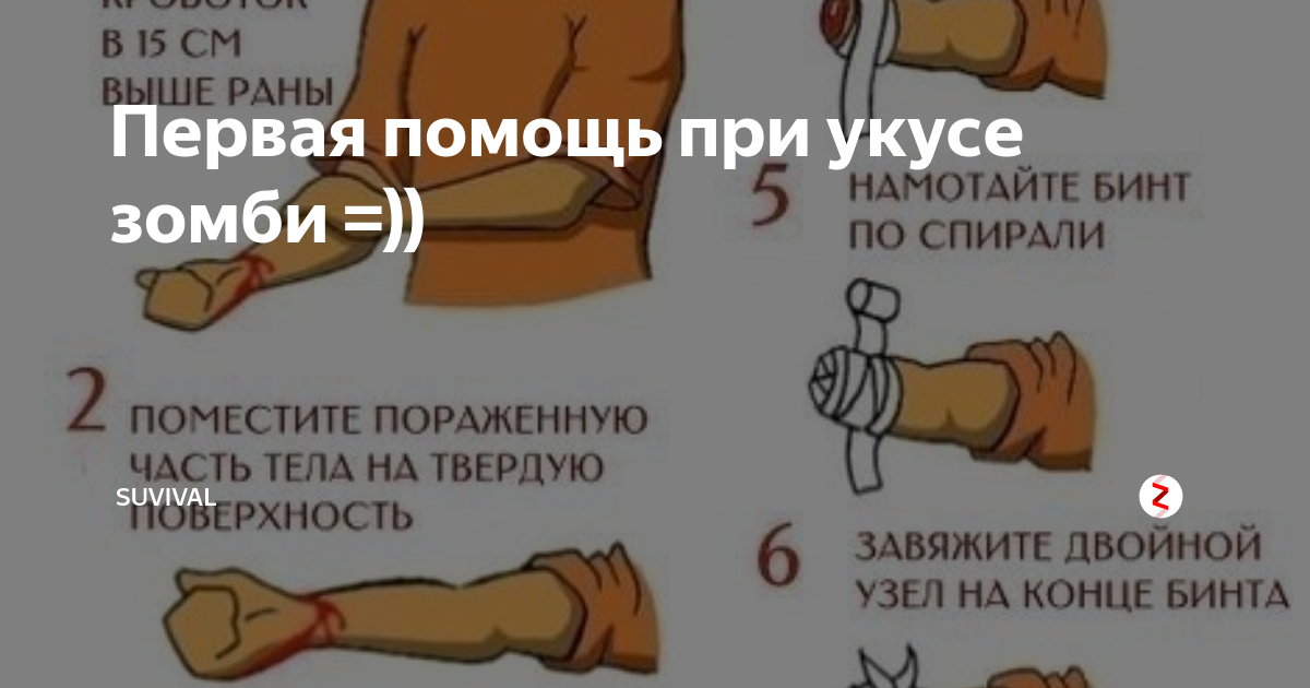 Как выглядит укус зомби