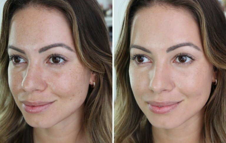 Фото моей девушки до применения  средства и после, результат на лицо)