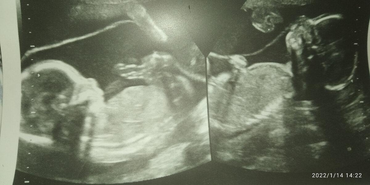 Тут мальчишкам 20 недель.