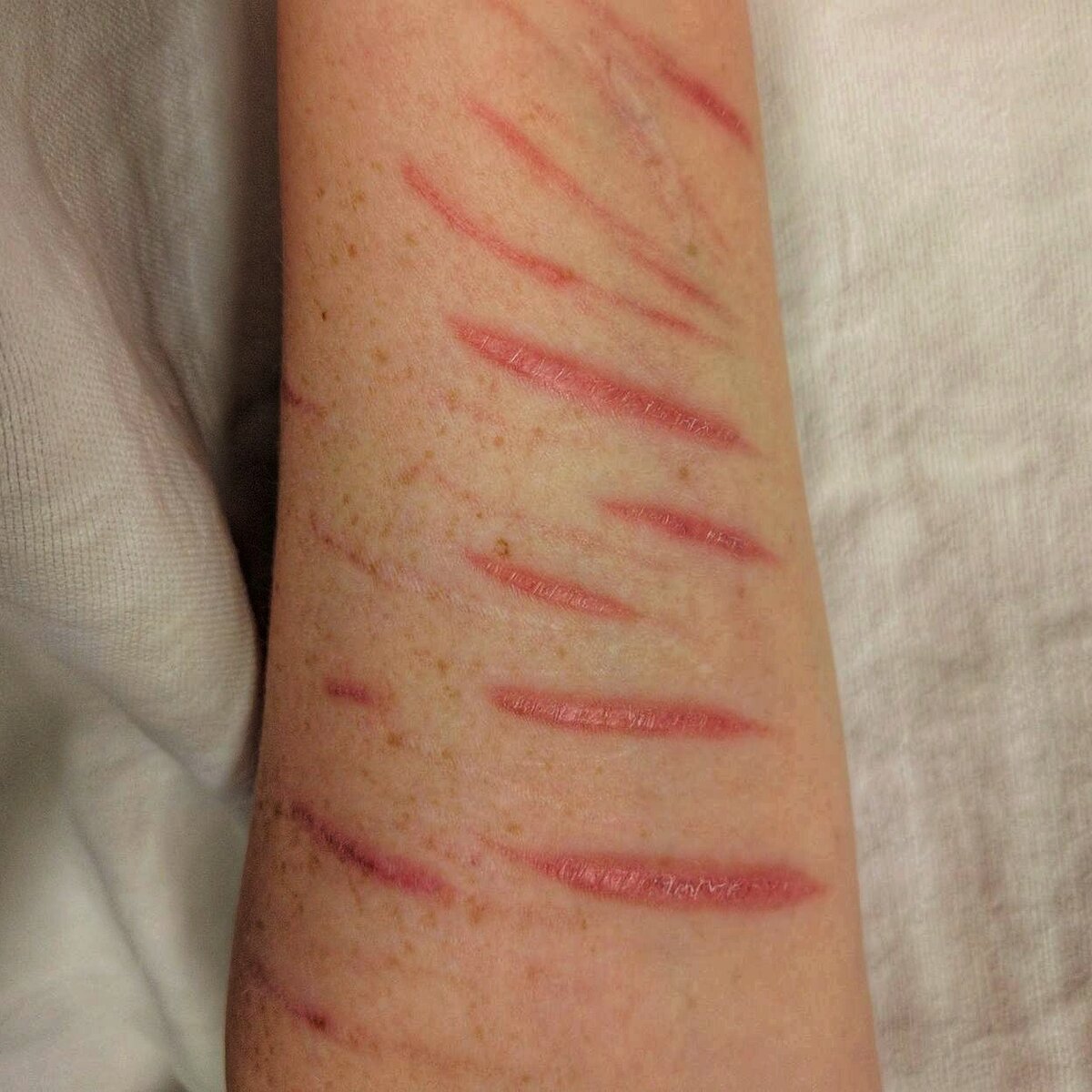 Никогда не режьтесь, даже нож в руки не берите