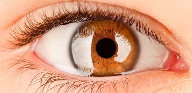 
Врачи были озадачены, когда две женщины, в возрасте 35 и 44 лет,сообщили о повторяющихся эпизодах слепоты, продолжительностью до 15 минут.