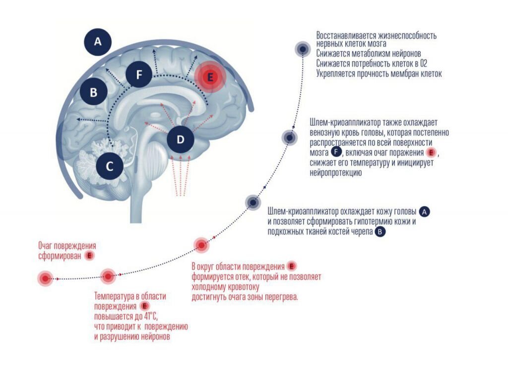 терморегуляция гипоталамус схема. внутренняя температура человека. заразен ли менингит у взрослых. какая температура мозга человека. какая температура мозга человека.