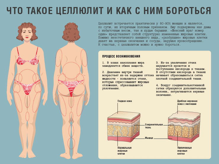 Диета против целлюлита: эффективные рекомендации по питанию для борьбы с апельсиновой коркой