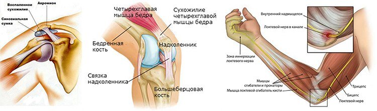 Мышцы стабилизаторы коленного сустава