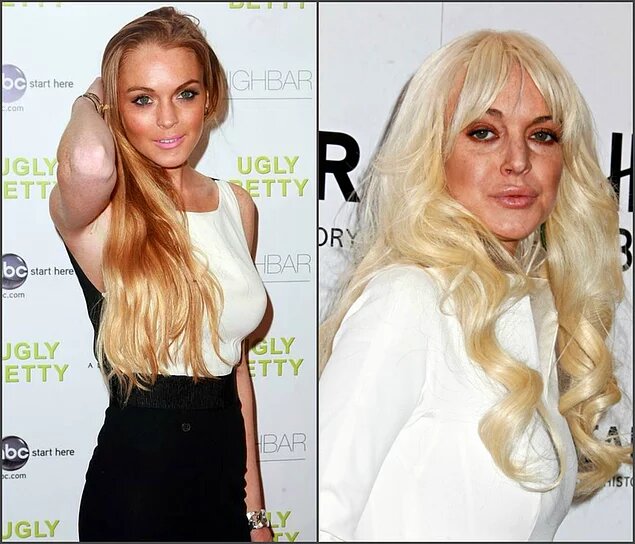 Вся жизнь Линдси - это реабилитационные центры, борьба с наркотиками и алкоголем, исправительные работы и аресты... Разумеется, такой ритм жизни не мог не сказаться на ее когда-то такой миловидной внешности.