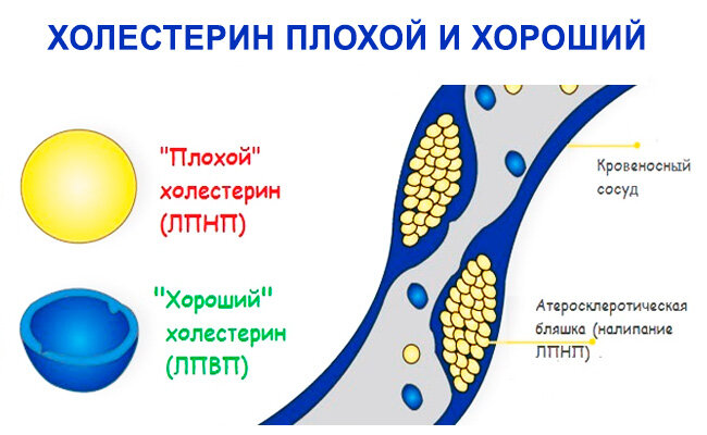 Источник фото: http://jazdorov.ru