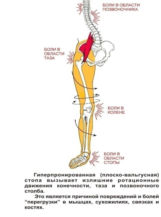 Бдль тазобедренный сустав. Болит спина и тазовые кости. Кости и мышцы таза анатомия. Неспецифический сакроилеит. Ломит таз.