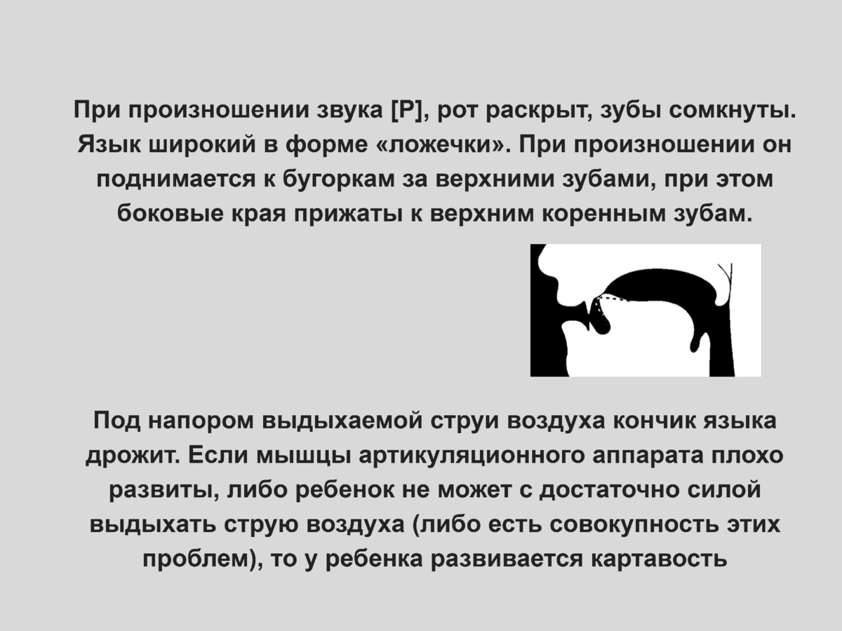 Так называемый профиль, показывает, как располагается язык во время произношения [р] и его мягкого варианта. 