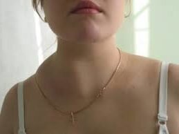 Лимфатические узлы в организме человека выполняют функцию поддержания иммунитета. Когда через них проходит кровь, отравленная токсинами или пораженная вирусами, узлы задерживают её и стимулируют рост специальных охранных клеток — лимфоцитов. Клетки уничтожают бактерии и вирусы, распространяются по организму и заканчивают работу.