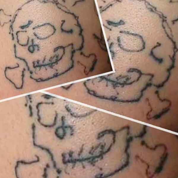 Татуировка череп в стиле "кракозябра".