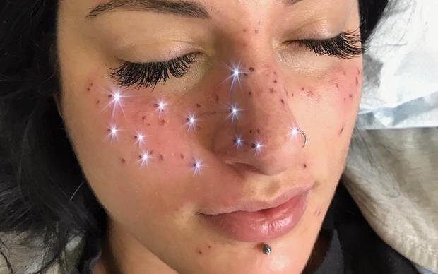   Мастер перманентного макияжа Джессика Напик из Мичигана (США) придумала новую услугу, а вместе с ней и броское название: астровеснушки (то есть astro-freckles или, как она сама их называет,...