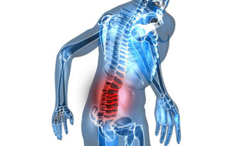  Фото: особенности повреждения позвонков в поясничном отделе