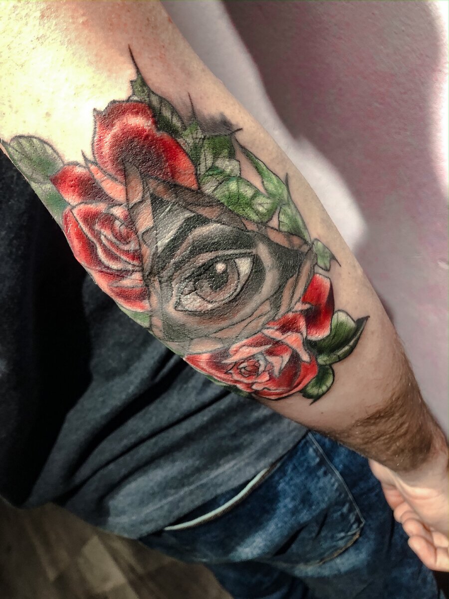 Локоть -боль. 